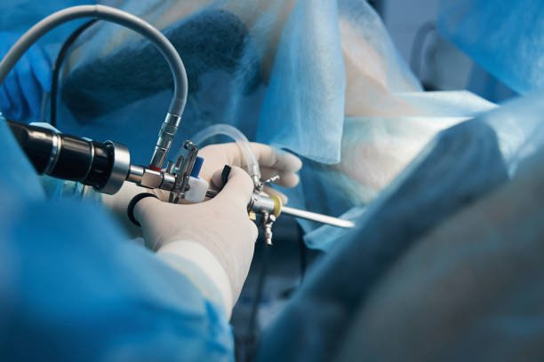 Histeroscopia Diagnóstica na VL Medicina